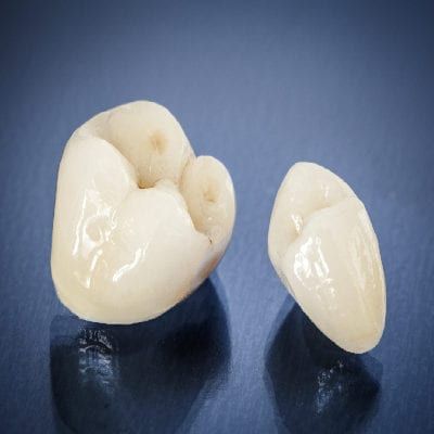 Dental crowns real over a blue surface