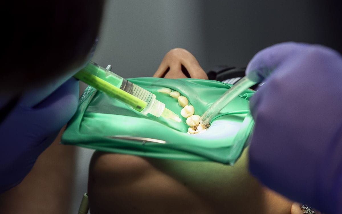 Person receiving a root canal