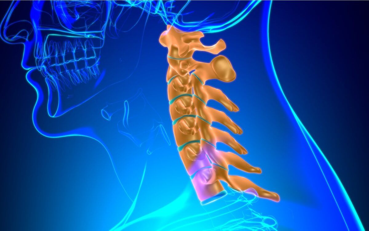 Cervical Vertebrae