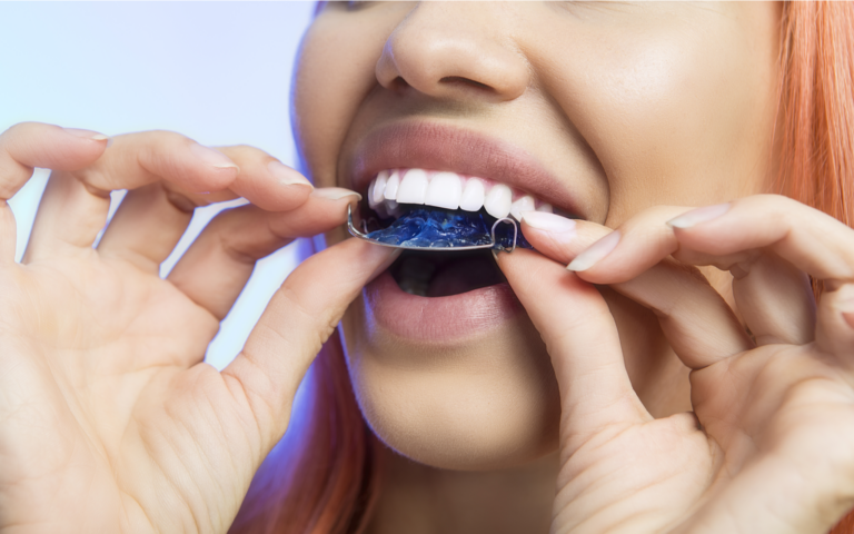Oral Health Cosmetic