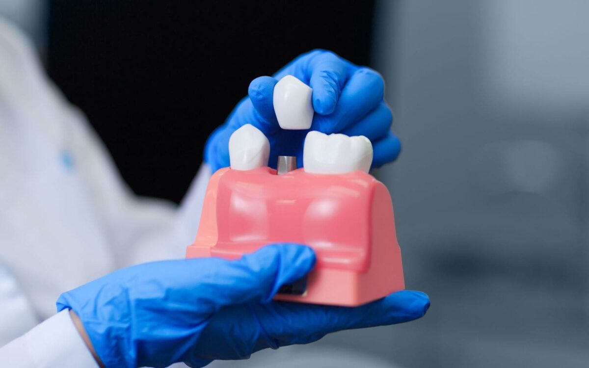 Dentist Showing Tooth Restoration Model