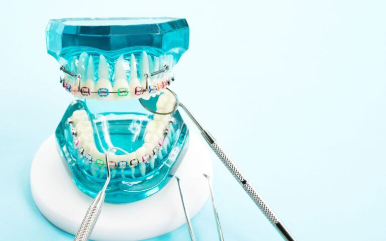 Model of Braces and Dental Tools